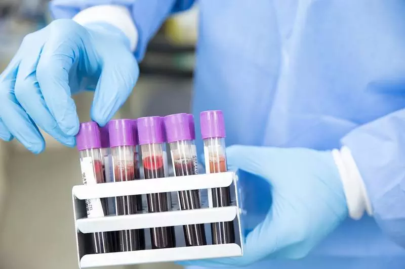 Białko związane z grupą krwi może wpływać na przebieg COVID-19